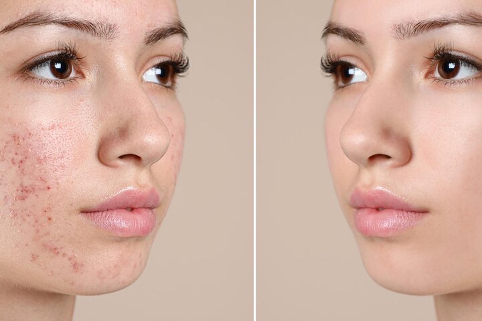Newport Beach Skin Glo Package for Two - Image 6