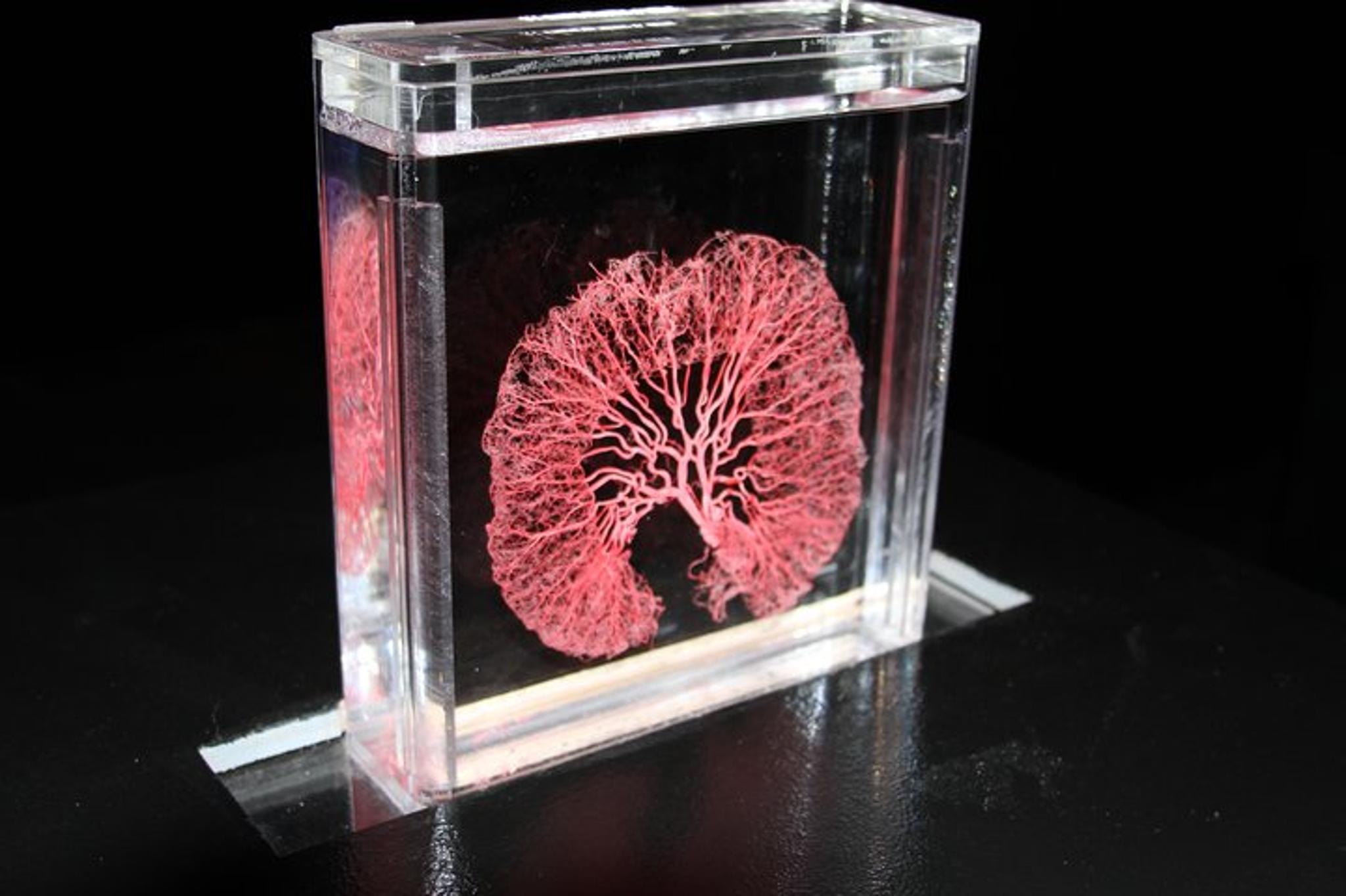 Las Vegas Real Bodies Exhibit - Image 3